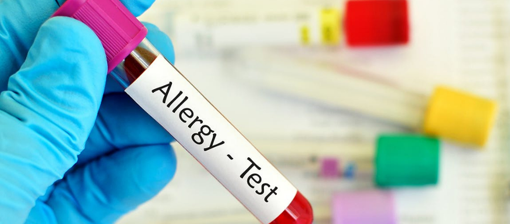 アレルギー検査の種類